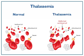 conseils santé thalassémie