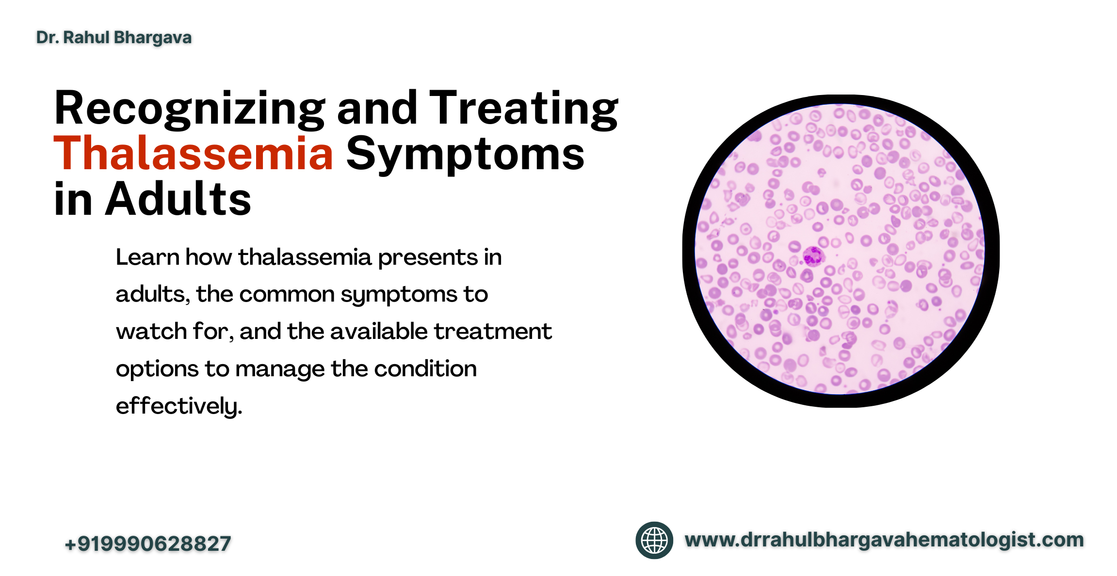microcytose thalassémie