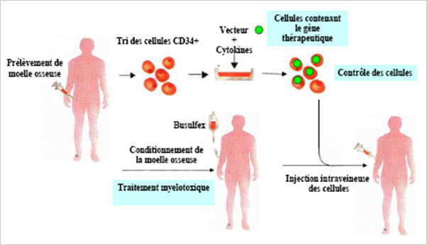 traitement de la thalassemie